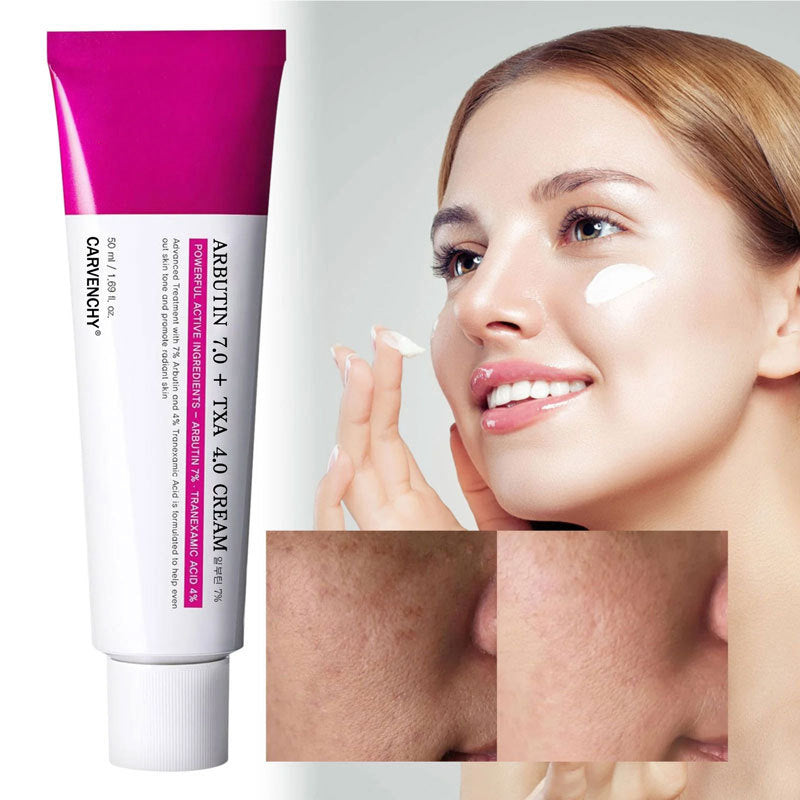 Arbutin &amp; Tranexamic Acid Dark Spot Cream